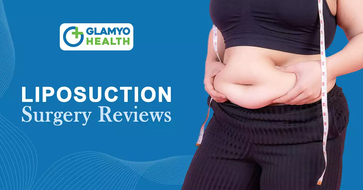 liposuction surgery reviews 