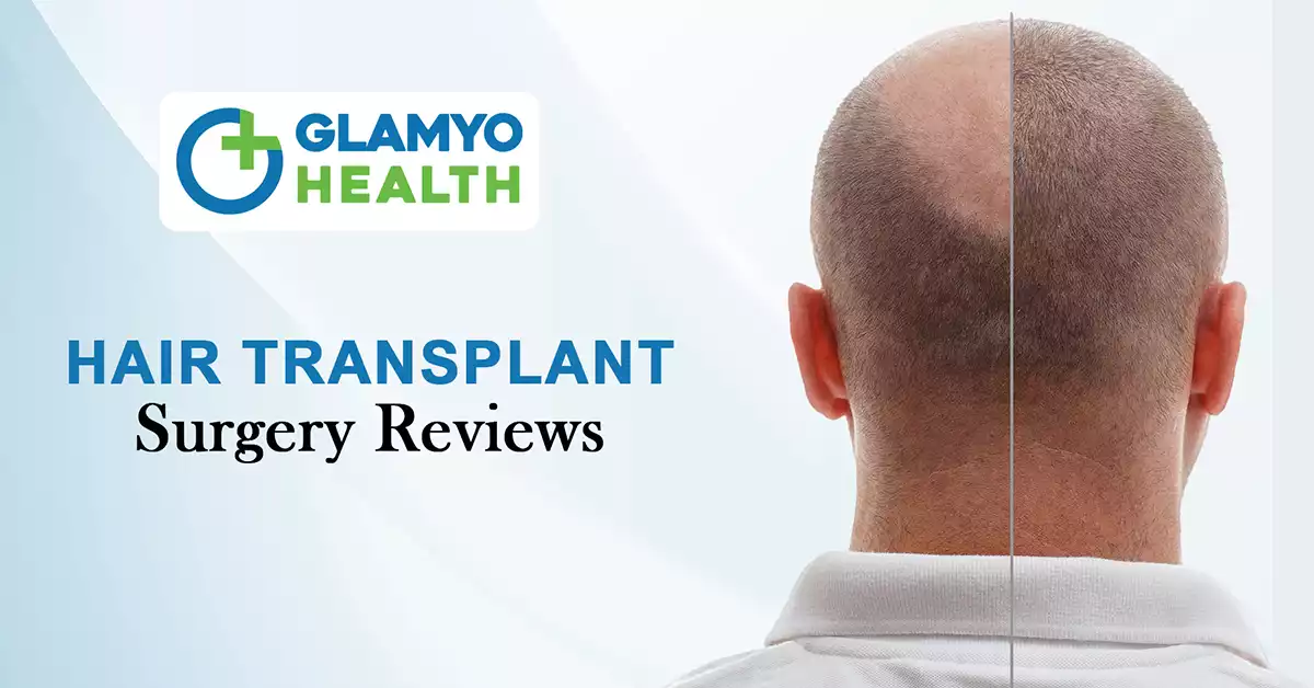 hair transplant treatment reviews 
