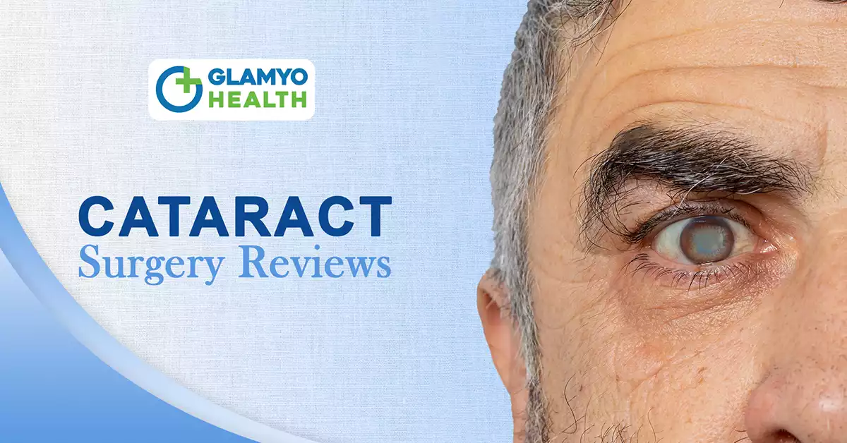 cataract surgery reviews 