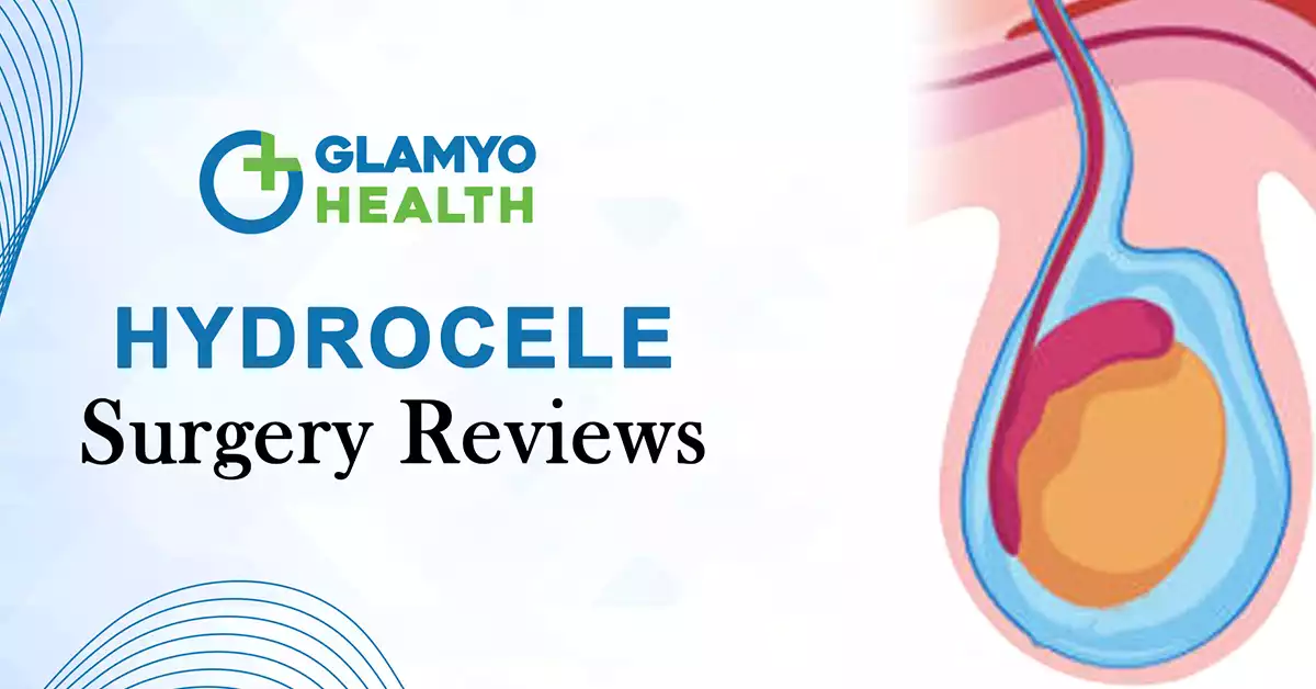 hydrocele surgery reviews 