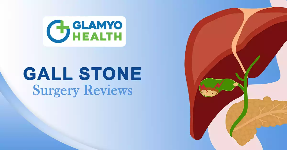 Gallstone Surgery Reviews